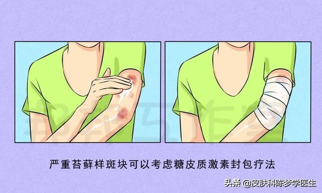晚上睡不着，皮肤痒痒痒，神经性皮炎该怎么办？