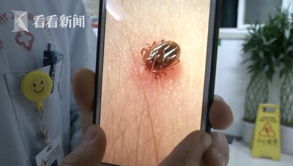 #你的育儿经#3岁女童油菜花地里游玩拍照 回到家脖子后的东西吓坏父母