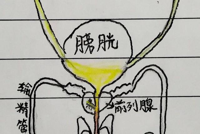 泌尿道|血尿原因有哪些？血尿如何治疗与预防？