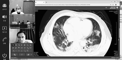 光明网：5G远程CT会诊落地雷神山