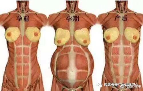 天空的彩虹|不做产后小腹婆-谈谈你的腹直肌