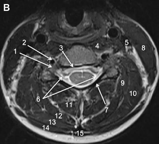 ռ׵ MRI ͼ