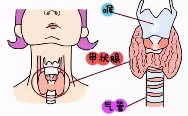 甲状腺癌|这种病居然长在孩子身上了，你敢想？才6岁