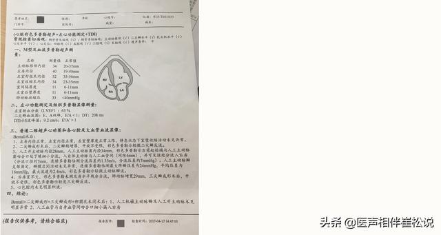 心电图|得了心脏病哪些检查最准确？这份“心脏检查指南”请收好！