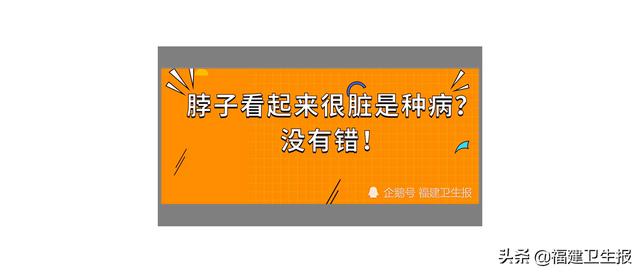 黑棘皮病|福州男子脖子黑洗不干净遭同事吐槽，医生：这是疾病向你发出信号