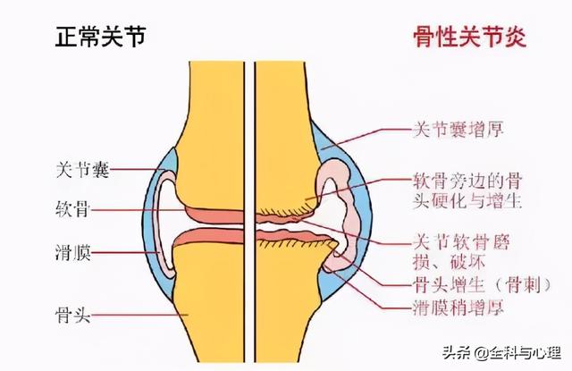 保护膝关节的8种减压法，建议收藏