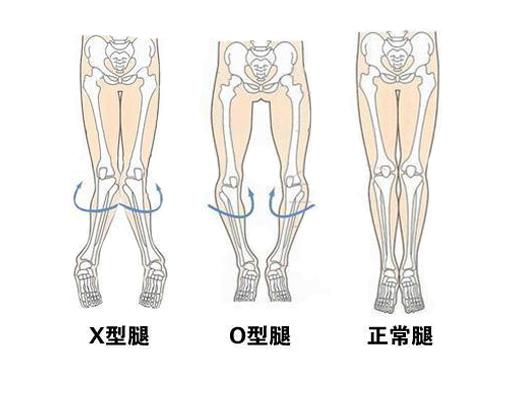 『你的育儿经』如何正确认识和治疗孩子的八字脚？