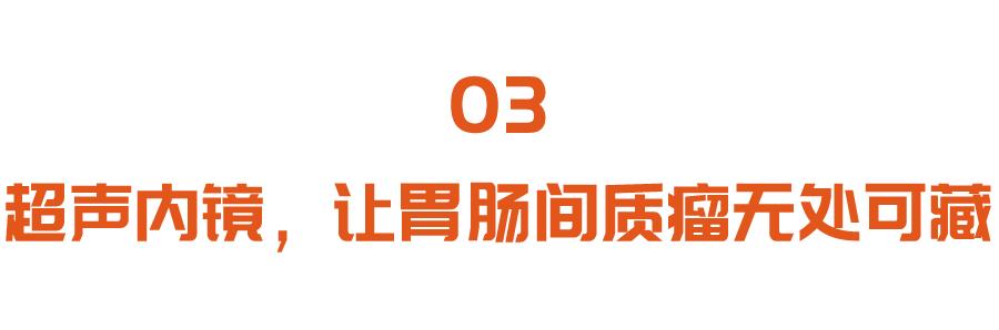 胃肠|这种长在胃肠的肿瘤，胃肠镜都难发现！五大症状，中一条都要当心