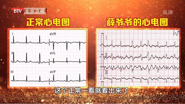 心跳过慢、过快、乱跳，都是因为它出了问题！赶紧摸脉自测一下