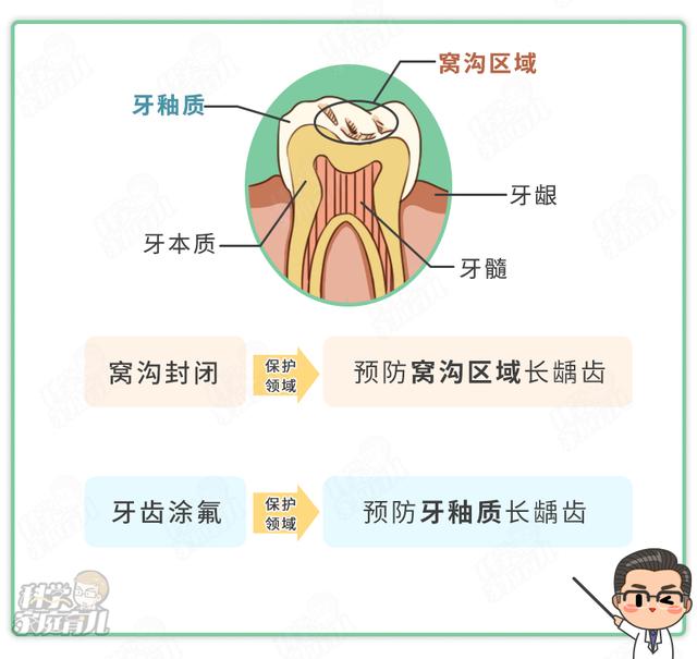 幸福相守|有些事牙科医生不轻易告诉你！窝沟封闭≠一劳永逸！后续做好3事