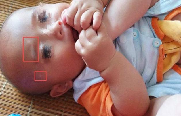 『超级宝妈』若孩子肚子里有没有蛔虫？主要看这些“信号”，看看你家娃有吗？
