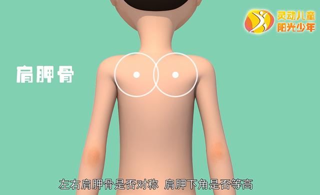 健康学堂|孩子高低肩，可能是病，这些脊柱侧凸自查方法，家长们一定要收藏