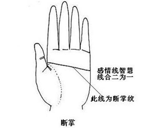 「超级宝妈」宝宝出生双手断掌,婆婆以为大富大贵,结果医生的话让人傻了眼