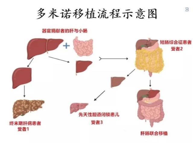 一年挽救958名器官衰竭者 这家医院的大器官移植真牛