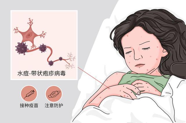 手足|春天来了，小心这三种容易感染儿童的传染病