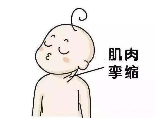 养生畅谈：宝宝经常歪头得注意，不是卖萌讨人爱，而是疾病在作祟