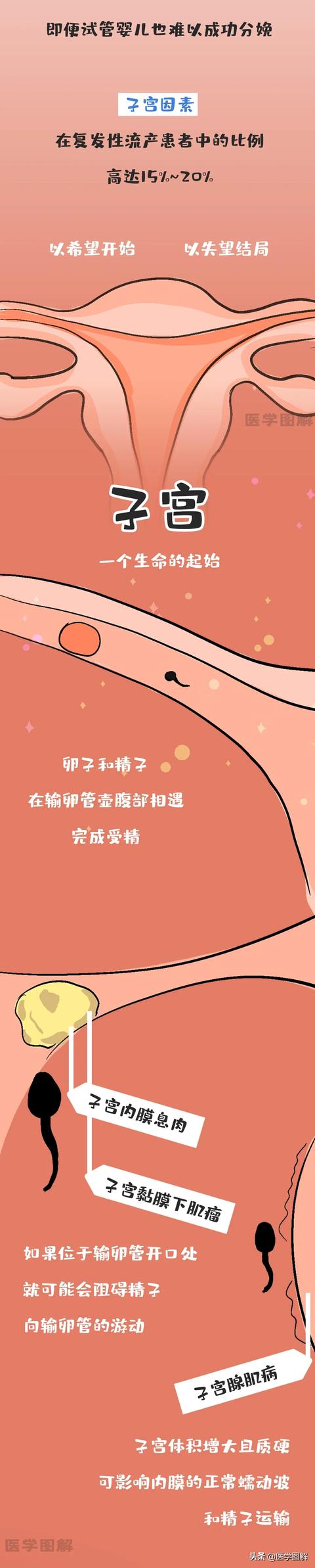 大眼睛的女孩|有这几种病，很难怀孕！就算试管婴儿，也可能失败丨医学图解