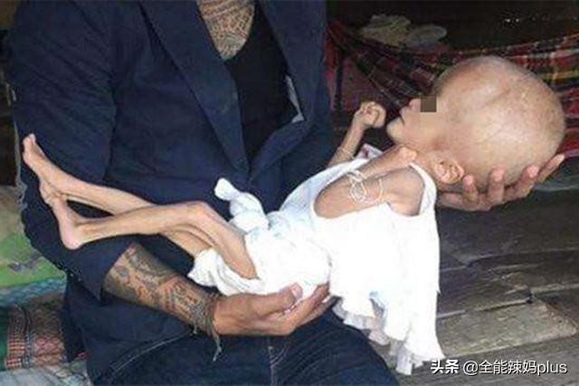 「超级宝妈」12年后，当年喝过“三鹿奶粉”的宝宝现状如何？网友：心疼又愤怒