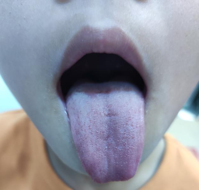 [你的育儿经]你的脾胃健康吗？