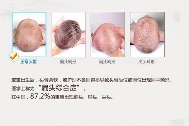 #超级宝妈#新生儿头型睡扁不要慌，改善扁头有三招，“正确睡姿”爸妈要知道