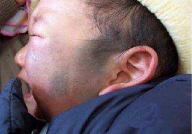『你的育儿经』为避免生下一个有胎记的宝宝,产妇在怀孕期间,要注意这3点