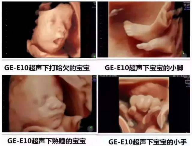 「你的育儿经」为什么E10四维彩超受到更多妈妈青睐？看完就知道了
