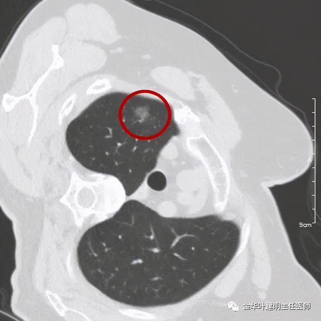 如此违反原则的手术方案设计，你支持吗？