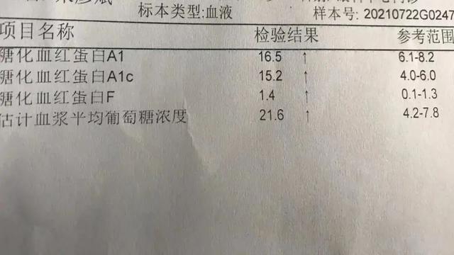 小林|15岁男孩眼球突然变白！居然是因为这个 夏季一定多注意