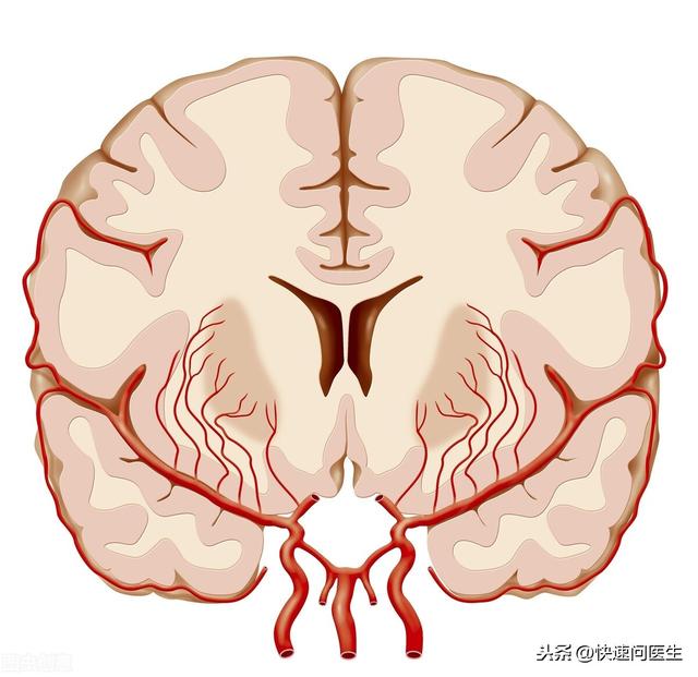 脑血管病有哪些表现？我们该如何预防，医生告诉你答案