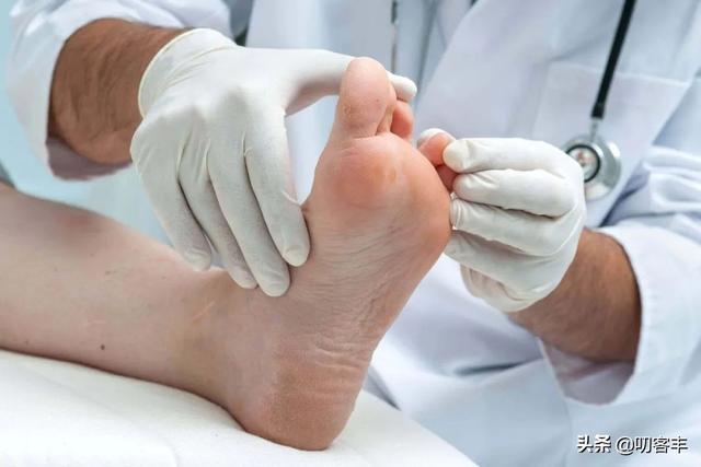 超级宝妈@孩子得脚气了，怎么办？