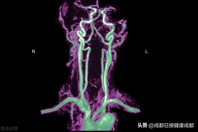 检查|如何选择医学影像检查？影像科医生来教你