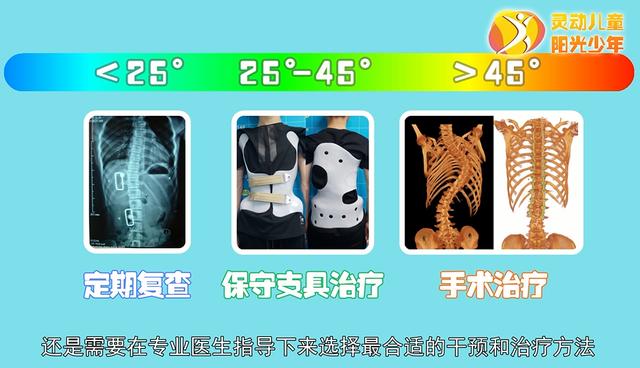 健康学堂|孩子高低肩，可能是病，这些脊柱侧凸自查方法，家长们一定要收藏