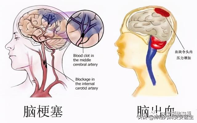 当身边人出现这些症状时，请一定要赶紧就医哦！（上）