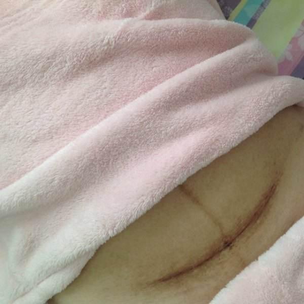 『超级宝妈』生孩子顺转刨腹产，这个疼痛过程男人真的理解不了