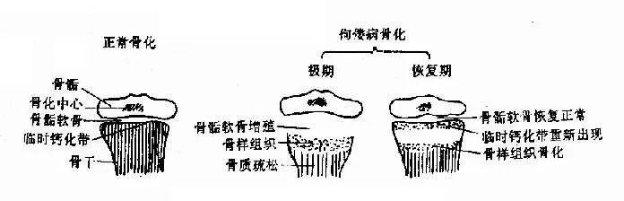 新华网客户端|新生儿补充维生素D容易中毒吗？如何正确补充？