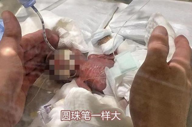 「超级宝妈」全世界最小的“婴儿”，仅和圆珠笔一样大，网友：简直是个奇迹