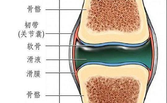 滑膜炎|关节积液？滑膜炎？到底该不该抽积水？关节医生这次给讲明白。