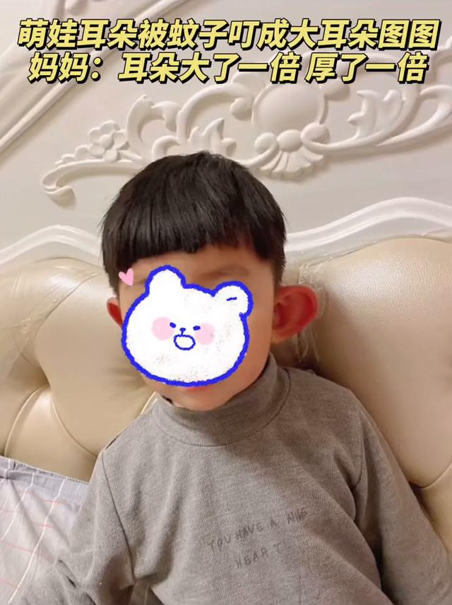 宝宝|萌娃耳朵被蚊子叮成大耳朵图图！妈妈：耳朵大了一倍 厚了一倍