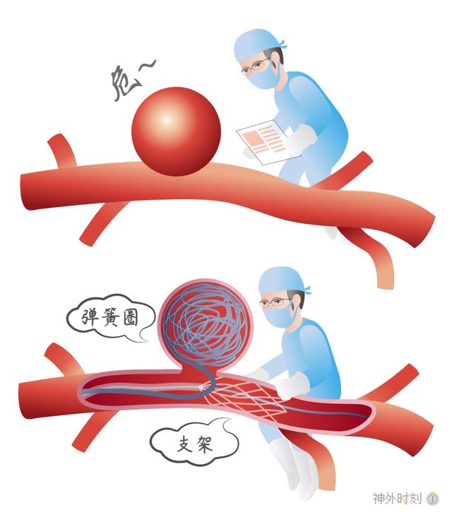 动脉瘤|降温了，要当心这个病哦