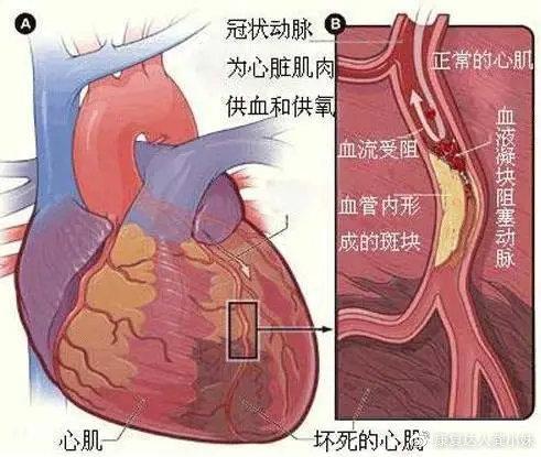 你的“小心脏”拍了拍你， 要注意啦！