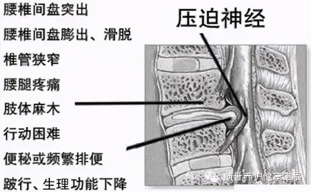 常见的八大骨关节疾病