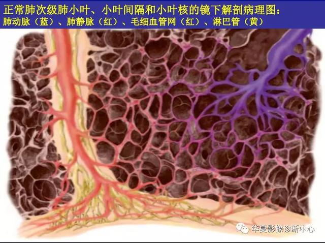 肺间质性疾病的解剖、病理、影像分析