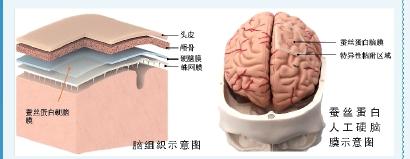 点“丝”成金！蚕丝蛋白变身高端医疗器械、硬盘存储，锁住生命与记忆