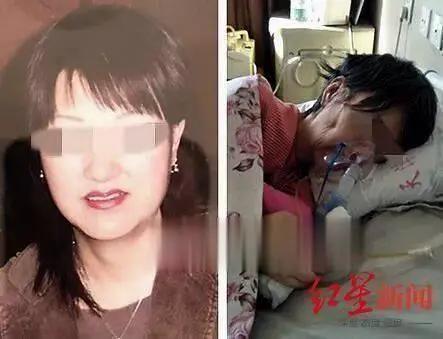 女商人抽脂成植物人10年后死亡！减肥靠抽脂，真的不靠谱