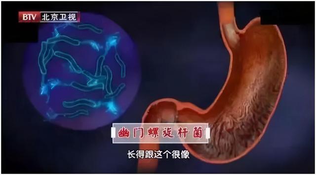 吃饭时的5个坏习惯，会变胖、致癌甚至致死！但你可能每个都在做