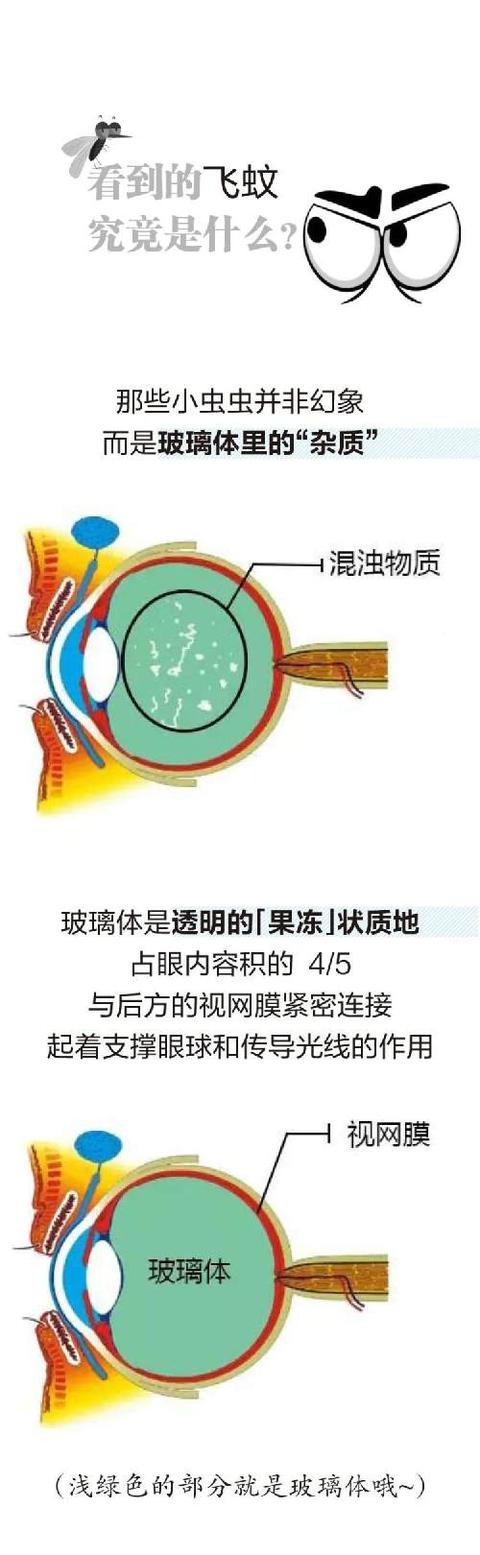 眼前总有黑影飘来飘去？真相在这……