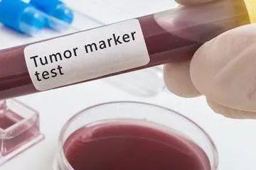 升高|体检发现肿瘤标志物升高，就是得了癌症吗？