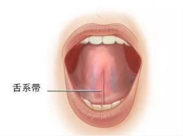 知道舌筋是哪里吗？人体这个器官太短，可能会影响宝宝正常说话