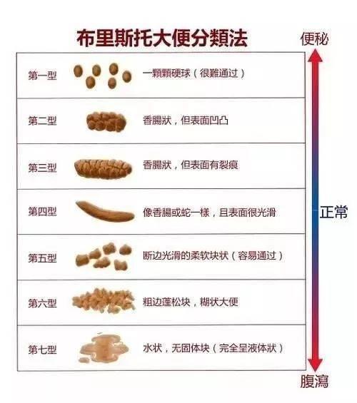 通过大便判断是否得癌？究竟什么样的大便，才是正常、健康的？