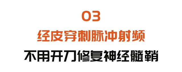 这种病痛起来生不如死！专家带来新技术，不用开刀，“一针止痛”